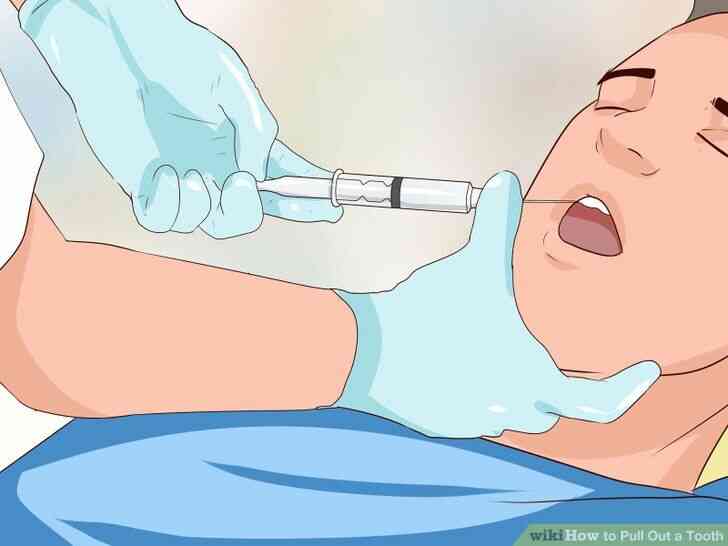 Image intitulée arracher une Dent Étape 10